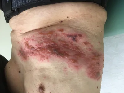 Как ухаживать за сухой кожей под мышками: советы и рекомендации