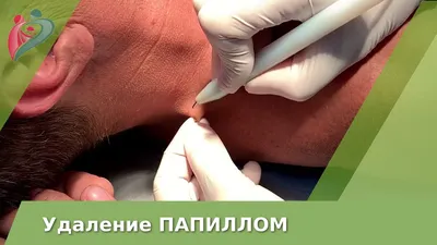 Избавится от запаха и пота под мышками