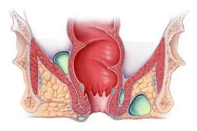 Лечение болезней прямой кишки - запись к проктологу в Туле | Эс Класс Клиник