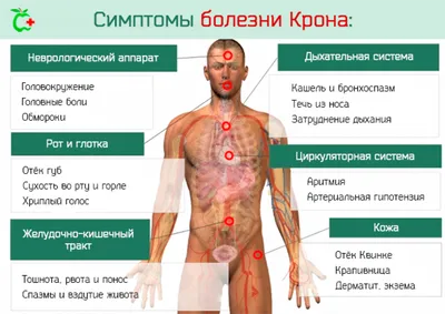 Перианальный дерматит - причины, симптомы, диагностика, лечение и  профилактика