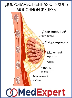 Заболевания молочных желез: причины, профилактика, лечение