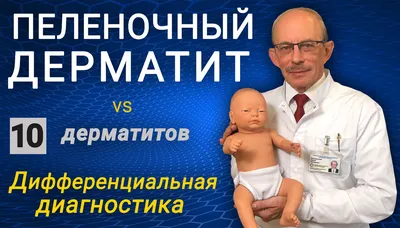 ПЕЛЕНОЧНЫЙ ДЕРМАТИТ И ОПРЕЛОСТИ У ДЕТЕЙ | Профилактика и лечение - YouTube