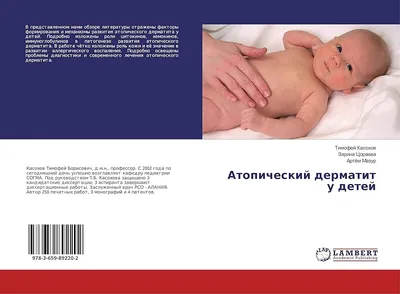 Мокнущая экзема на голове у малыша — 4 ответов | форум Babyblog