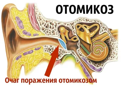 Лечение воспаления уха в Ростове-на-Дону взрослым и детям