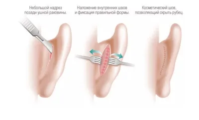 Смесь эфирных масел №1 Ухо-горло-нос