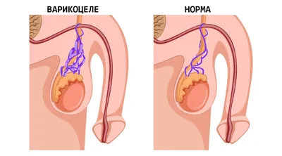 Дисгидротическая экзема - симптомы и лечение у взрослых. МЦ «Здоровье» в  Москве ЮАО (Варшавская и Аннино), ЦАО (Краснопресненская и Рижская).