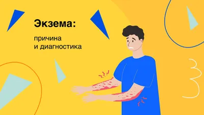 Лечение экземы в Харькове - Центр европейской дерматологии