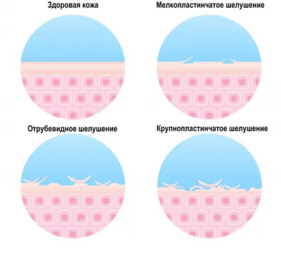 Почему трескается кожа за ушами: возможные причины и способы лечения