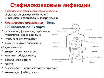 Стафилококк. Симптомы, виды, причины возникновения и лечение заболевания –  Семейная клиника «Доктор АННА»