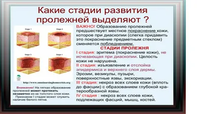 Эрозия кожи. Большая российская энциклопедия