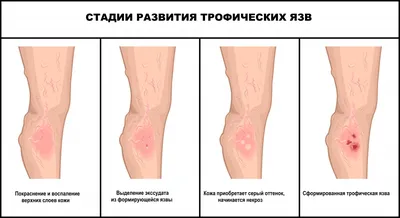 Сыпь на коже, на теле — Derma.ua