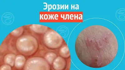 twac.phillex... - Косметологическая клиника Beauty Control | Facebook