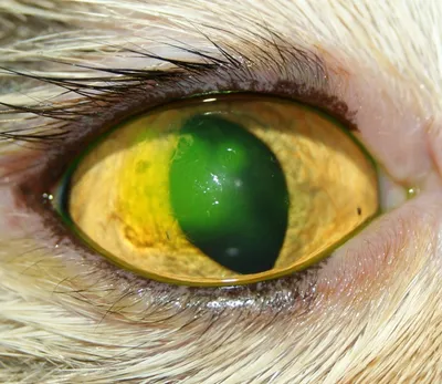 Рисунок 10 Фото глаз пациентов до лечения. а) линейная рецидивирующая …