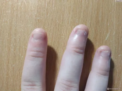 Если ребенок грызёт ногти.: manichenko — LiveJournal