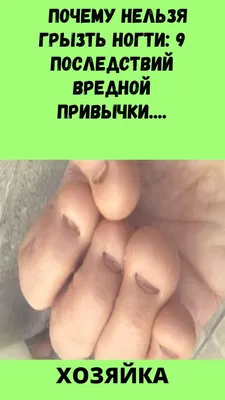 Лак-препарат против обгрызания ногтей Бельведер купить недорого в Москве