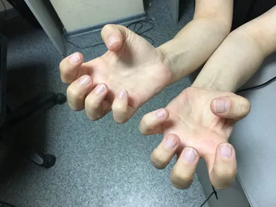 Как не грызть ногти