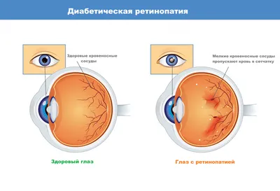 📸 Как фотография со вспышкой может указать на наличие проблем со зрением?  😍Что означают красные глаза на ф.. | ВКонтакте
