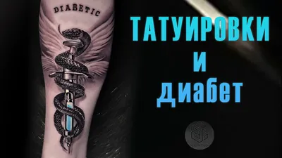 Как вывести татуировку и забыть о ней навсегда: способы сведения тату -  блог Lbar