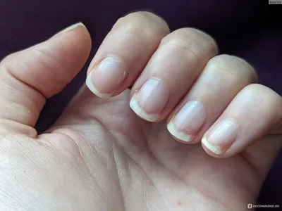 liana_nails - Какой маникюр лучше – обрезной или европейский? Каждая из нас  индивидуальна, поэтому и выбор маникюра будет отличаться. 💅ЕВРОПЕЙСКИЙ  МАНИКЮР. Подходит тем, у кого практически нет кутикулы или близко  расположены капилляры.