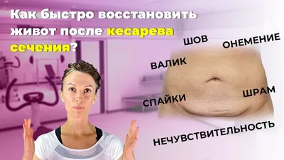 Абдоминопластика живота в Красноярске - цена пластики живота - КИТ