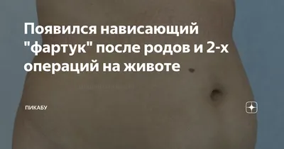 Валик над швом после кесарева: реальный способ справиться с проблемой, даже  если вы в декрете! - ФЕРМЕНКОЛ