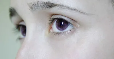 Фиолетовые глаза в реальной жизни | Циничная Европа | Дзен