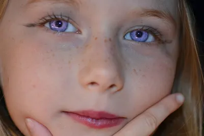 11 Самых редких цвет глаз | FUN FACTS | Дзен