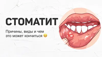 Что такое альвеолит зуба и как его лечить? | Silkdentist