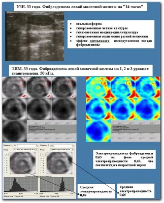 BI-RADS — исследование молочных желез — 24Radiology.ru