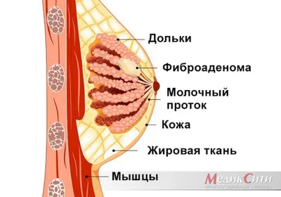 УЗИ (Ультразвуковое исследование) молочных желез - «26 лет в диагнозе ФКМ!  Делаю УЗИ молочных желез 2 раза в год. Как пережить подозрения на  онкологию? Как отличить фиброаденому от кисты на УЗИ? Классификация