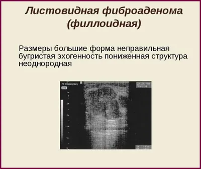 BI-RADS V категории