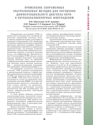 BI-RADS — исследование молочных желез — 24Radiology.ru