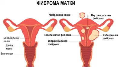 Онко Вики — Какие новообразования возникают на коже?