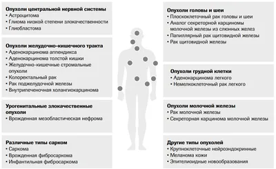 Саркомы мягких тканей - симптомы, признаки.