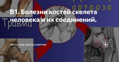 Эпулис - причины, виды, симптомы, диагностика, лечение (операция по  удалению), профилактика