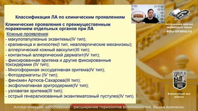 Аллергия весной: симптомы, диагностика и лечение: Уход за собой: Забота о  себе: Lenta.ru