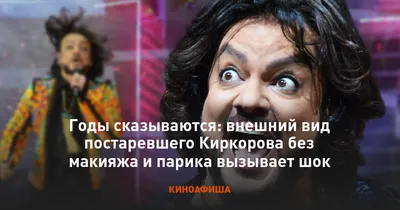 Годы сказываются: внешний вид постаревшего Киркорова без макияжа и парика  вызывает шок