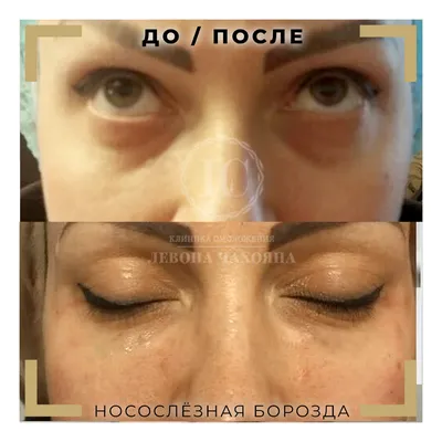 Антиэйдж процедуры в 30+: что делать? | Beauty Insider