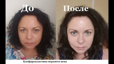 Тестируем микротоковый аппарат Bio Visage от Mansard - BeautyHunter.ru