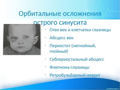 Dr. Ani Hovhannisyan - Флегмона - острое гнойное разлитое воспаление  подкожной, межмышечной и межфасци-альной рыхлой жировой клетчатки. В  детском возрасте флегмона часто развивается как осложнение острого гнойного  лимфаденита (аде-нофлегмона) или ...