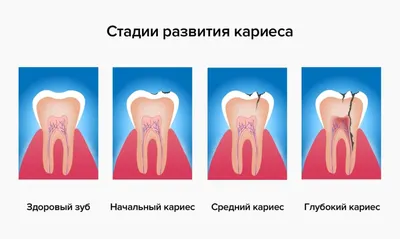 Флюс и абсцес: причини, диагностика