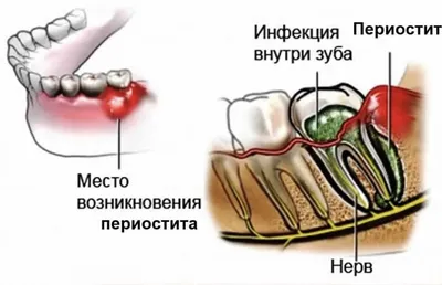 Флюс на десне у ребенка - стоимость услуги Детская стоматология в Киеве,  Флюс на десне у ребенка - цена в стоматологии lipinskii.com.ua