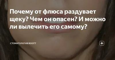 Флюс зуба: что делать, если раздуло щеку