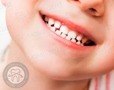 Флюс зуба – в чем опасность?