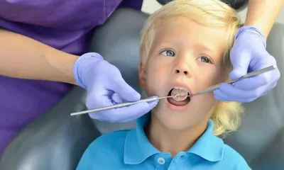 Лечение флюса в Саратове, платная стоматология