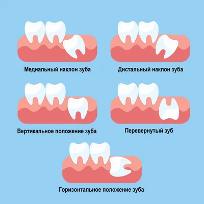 Клостилбегит таблетки 50 мг флакон №10 - в наличии: 120+ аптек Киев Львов