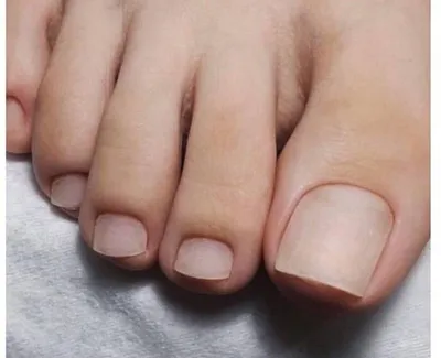 Какой должна быть идеальная и удобная форма ногтей на ногах. | KG_nails  маникюр на дому | Дзен