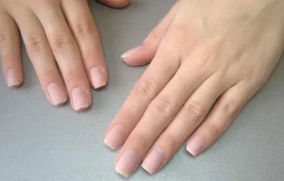 Какая форма ногтей мне подойдет Rinail.ru
