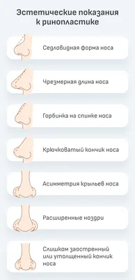 Как изменить форму носа без операции: альтернативный способ - 7Дней.ру