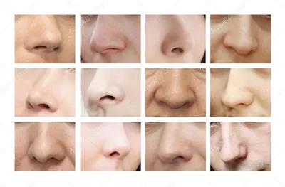 Носы бывают разные... Нам нужен красивый! | NEWFACE (Facebuilding) | Дзен